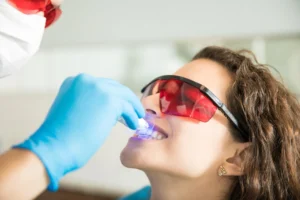 Cuánto dura un blanqueamiento dental