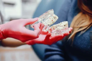 Precios de las carillas dentales